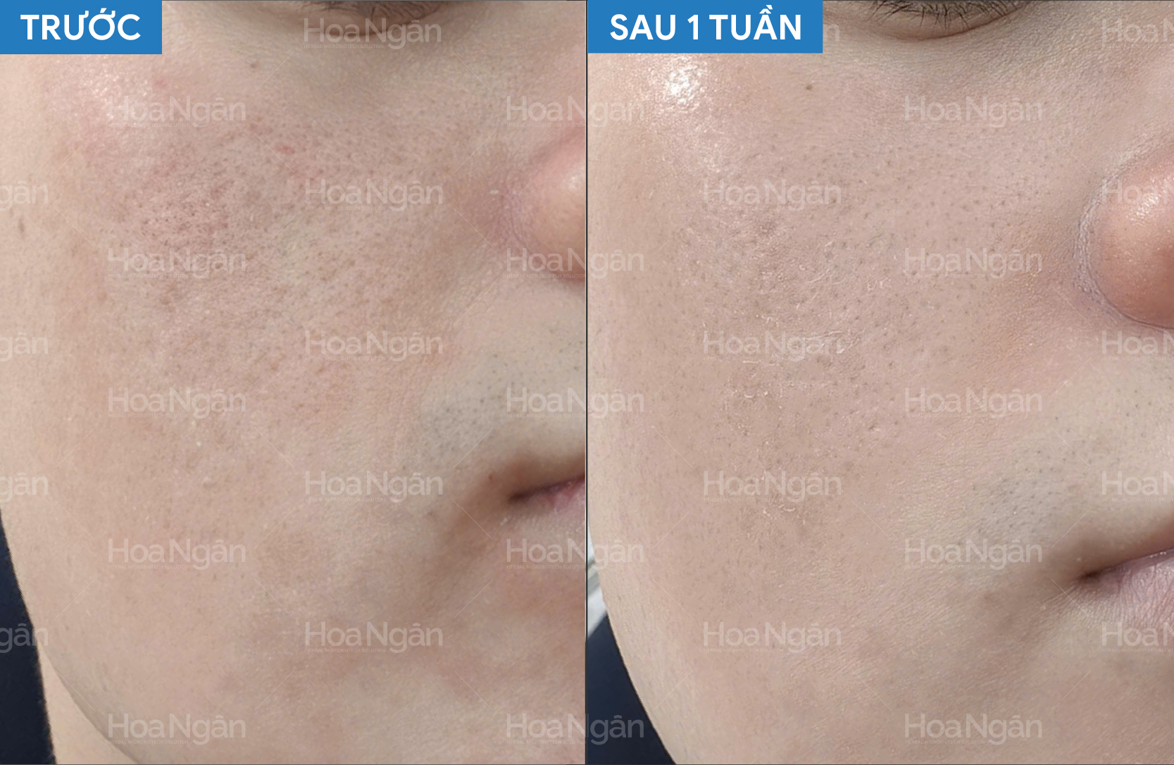 Cấp ẩm sâu và căng bóng hơn sau 7 ngày