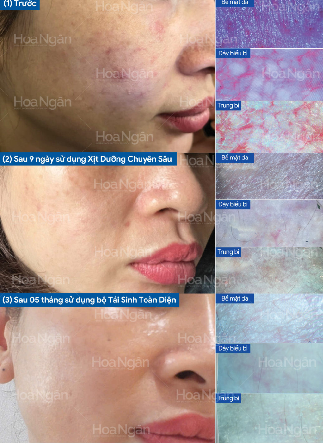 Kết quả thực tế dưới máy soi đa tầng