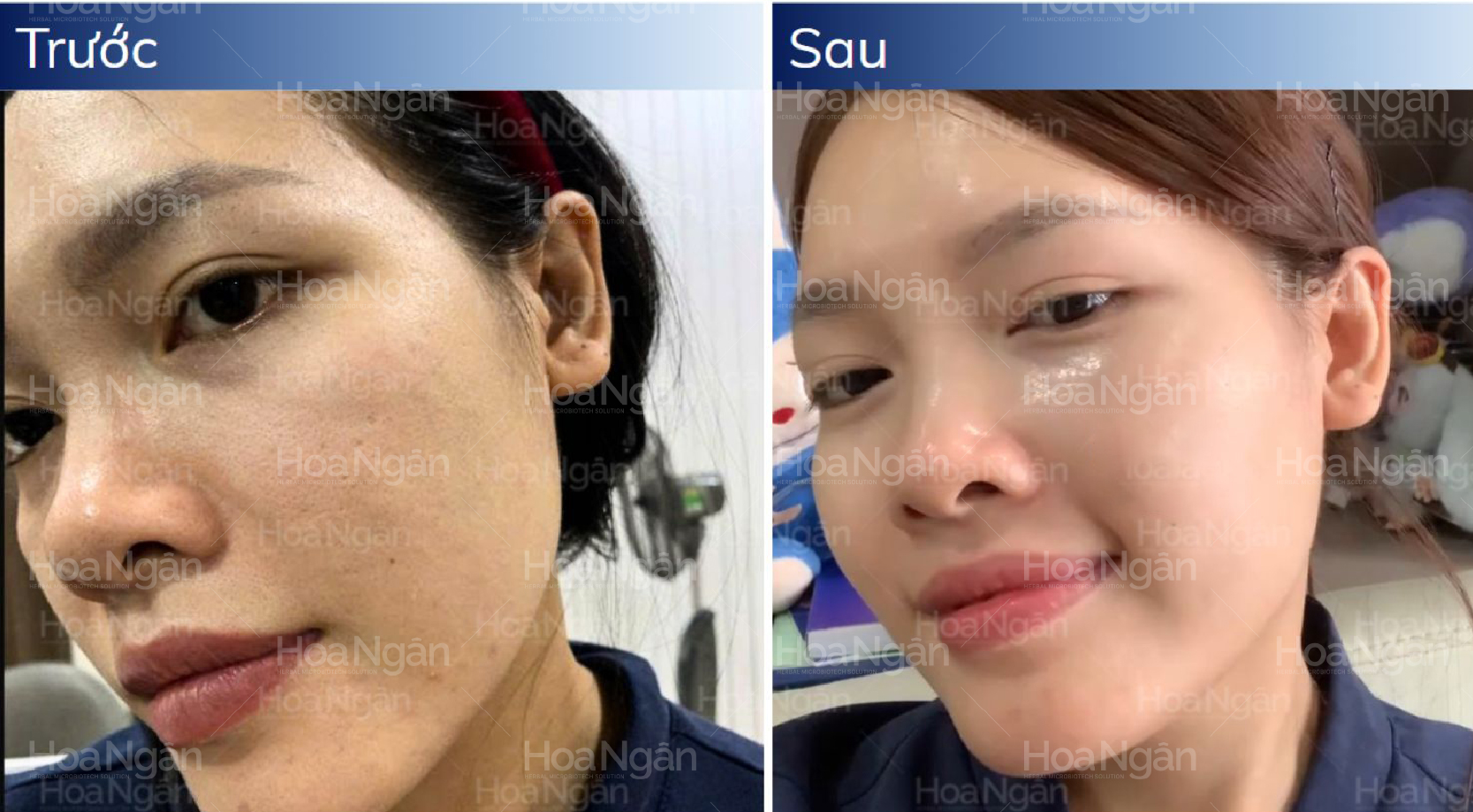 Kết quả trước sau bước 3