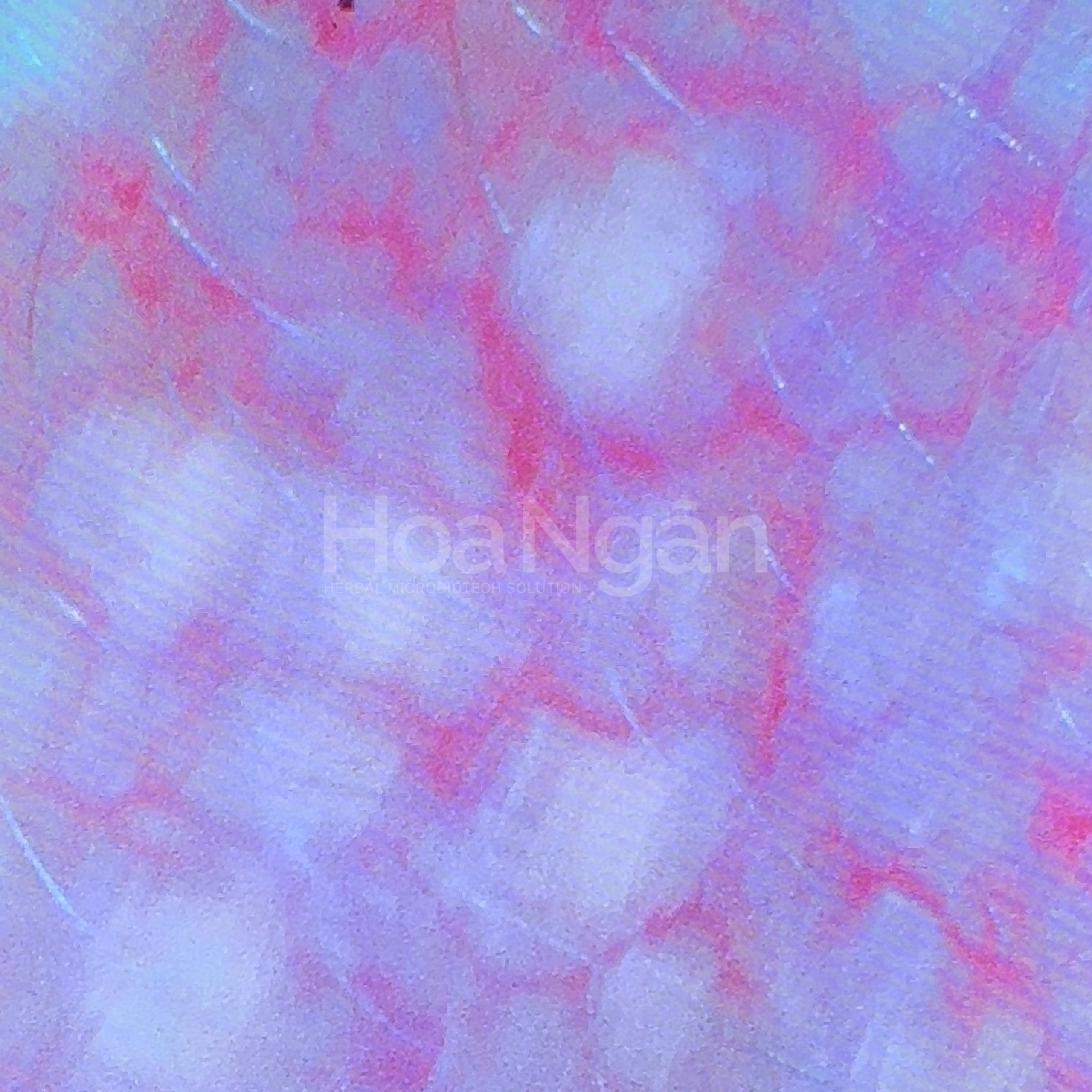 Hình ảnh soi da tầng đáy biểu bì trước quá trình sử dụng sản phẩm Hoa Ngân